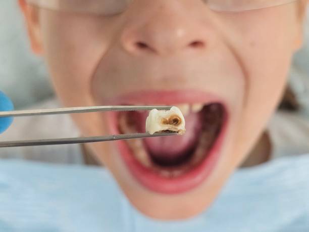 Best Urgent Tooth Repair  in Indian Head Park, IL