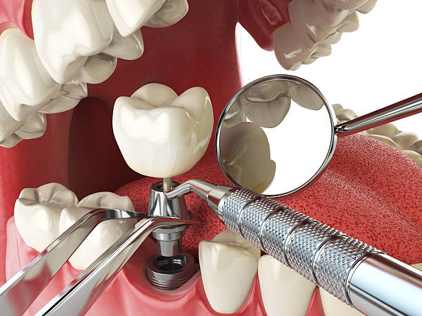 Best Broken Tooth Emergency  in Indian Head Park, IL